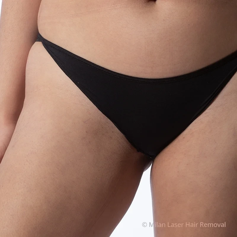 Bikini after