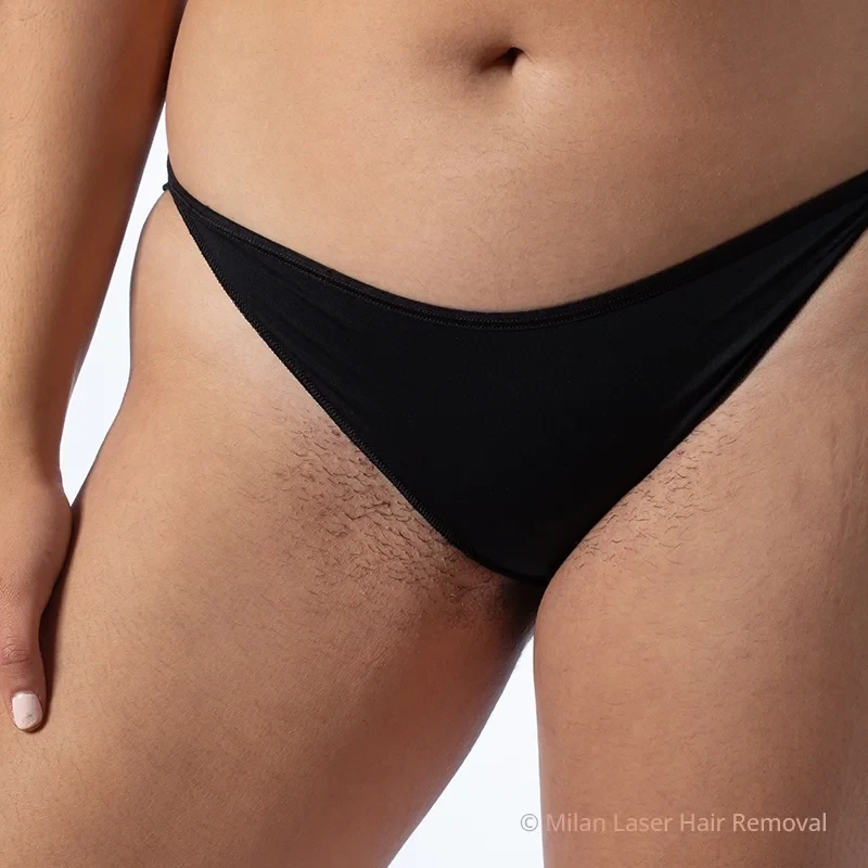 Bikini before